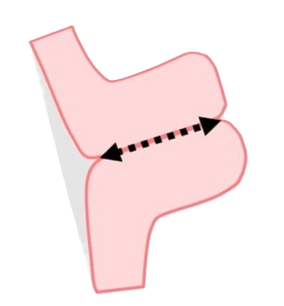 Normal cervix