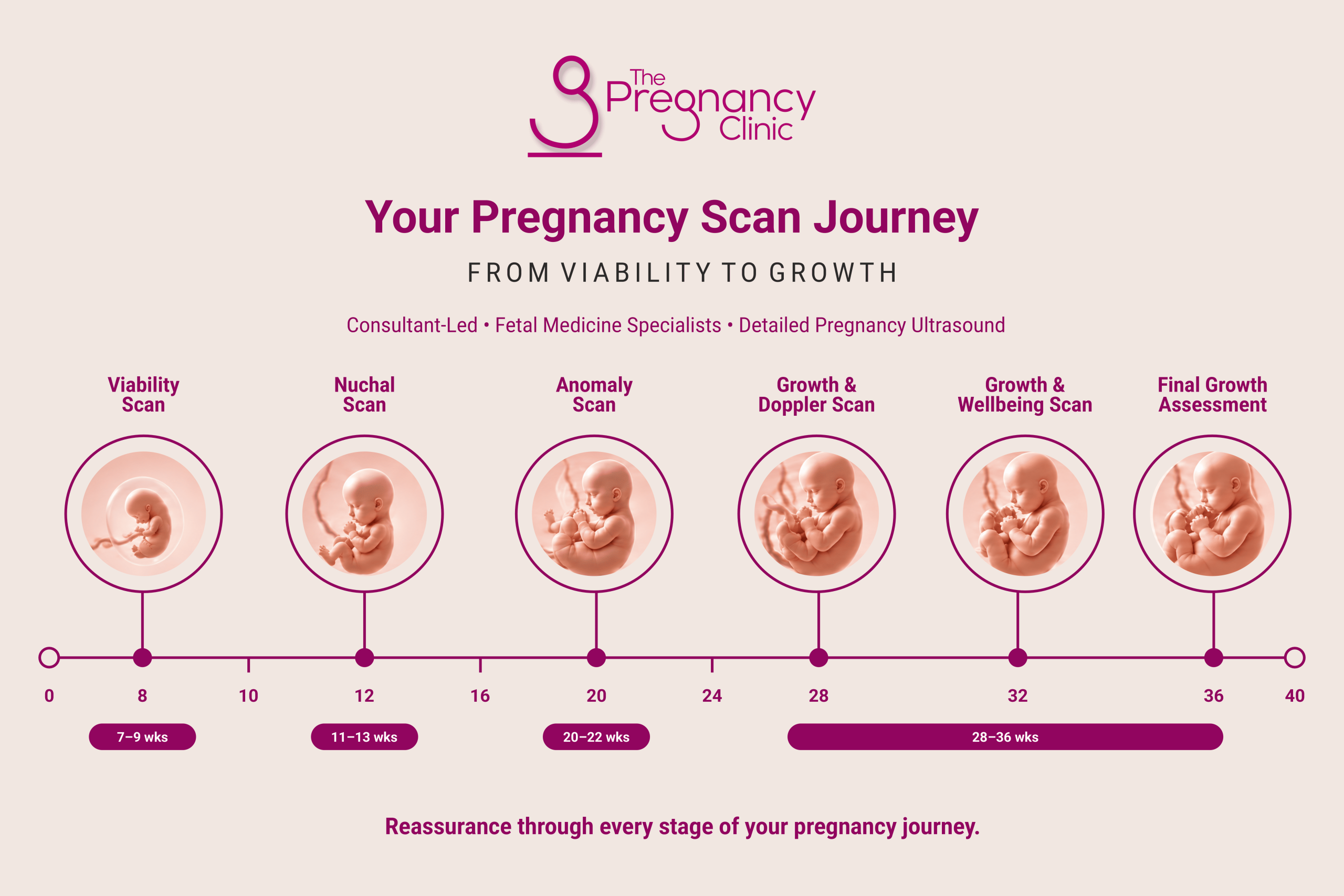 Pregnancy scan
