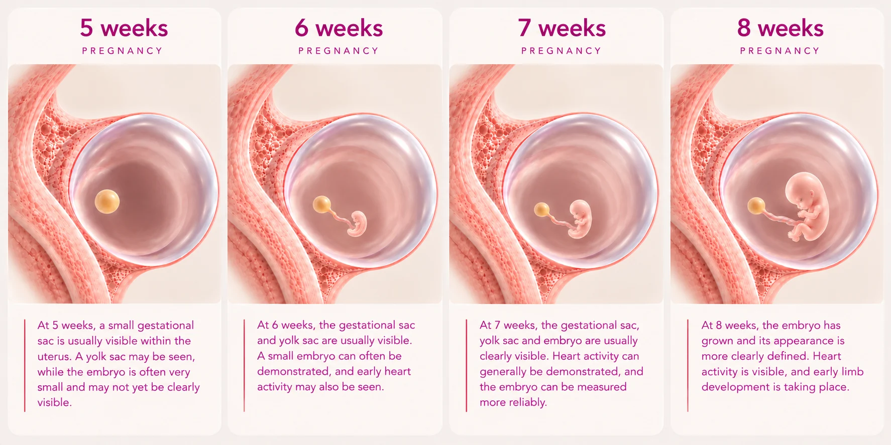 Illustration of early pregnancy development at 5, 6, 7 and 8 weeks, showing the gestational sac, yolk sac and growing embryo